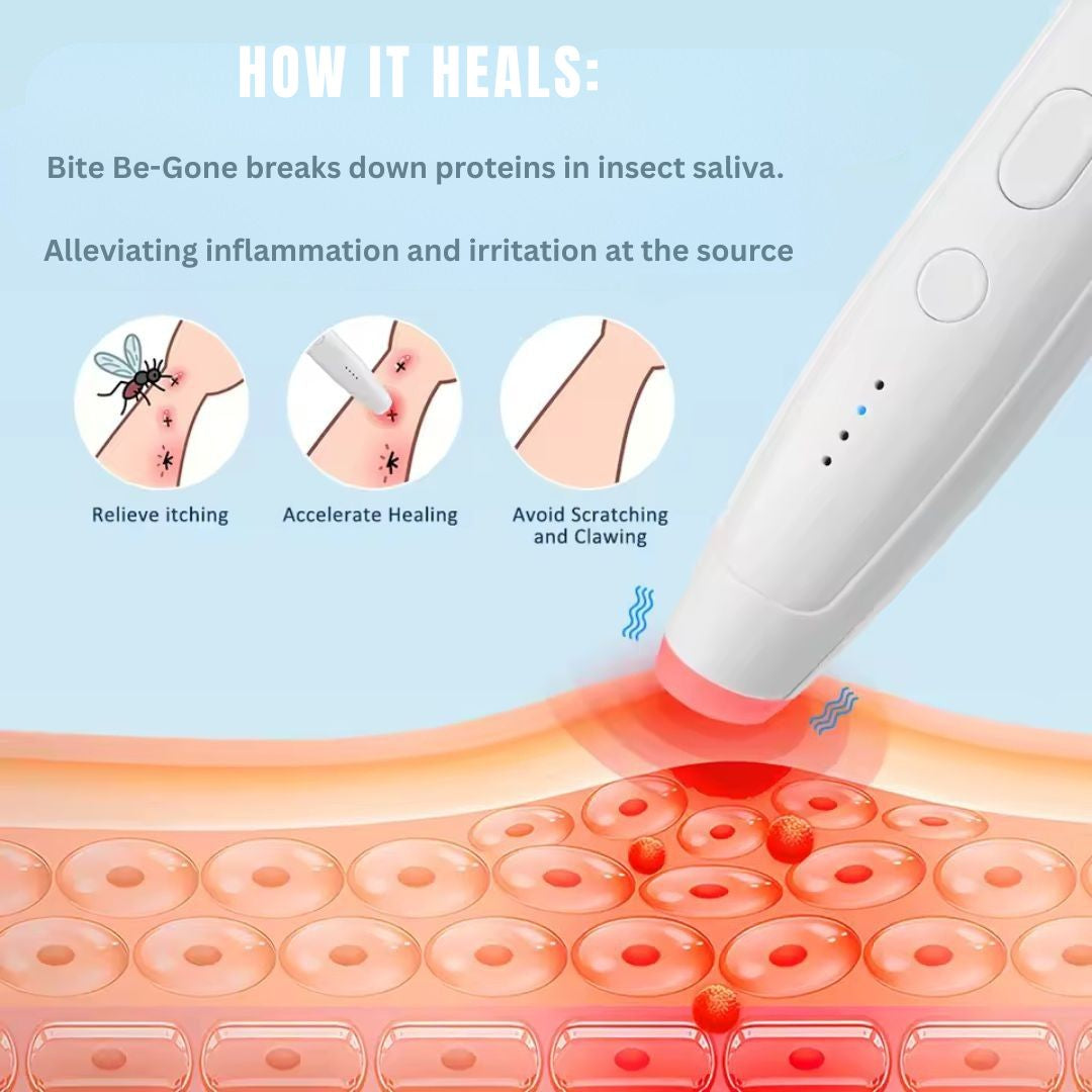 Bite Be-Gone™