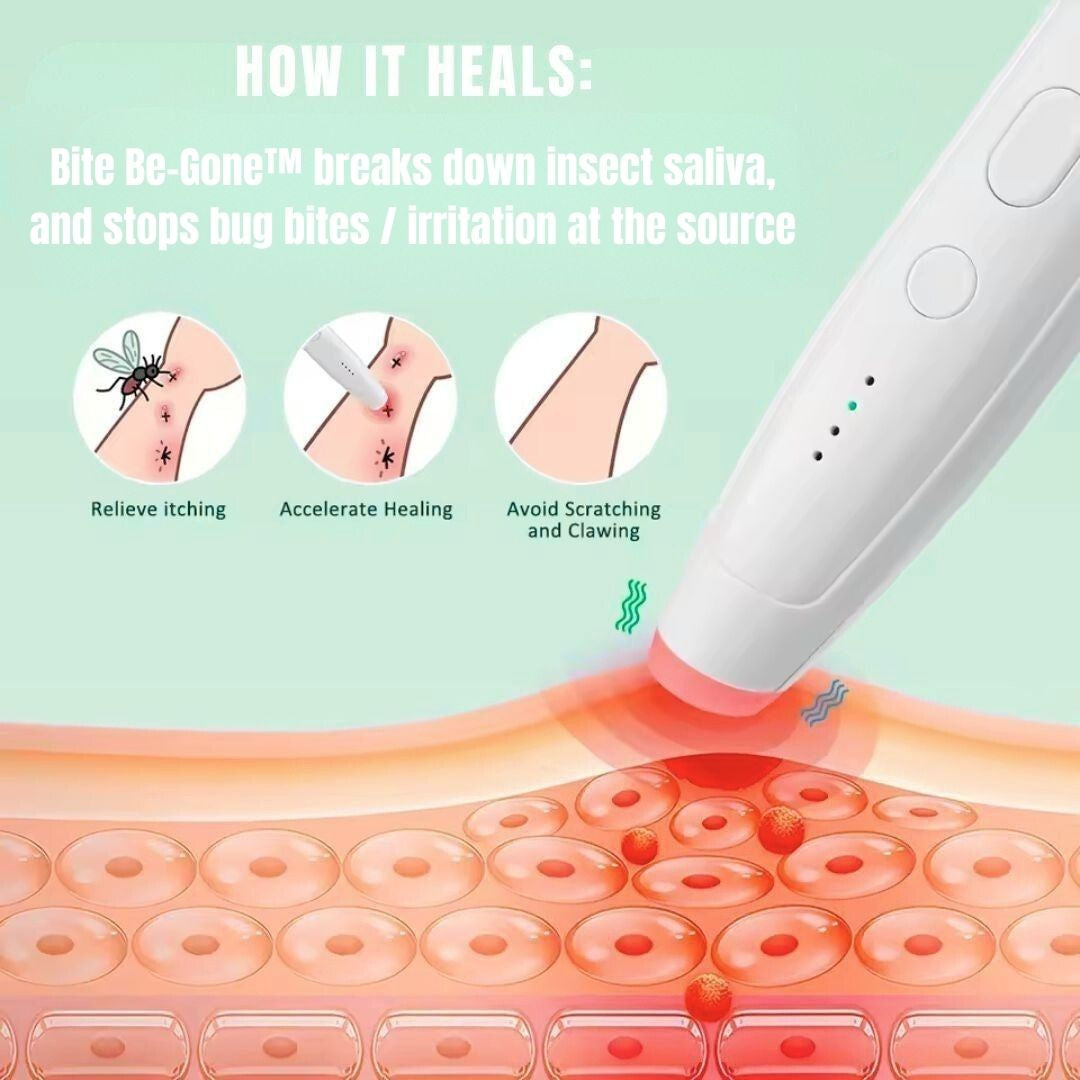 Bite Be-Gone™